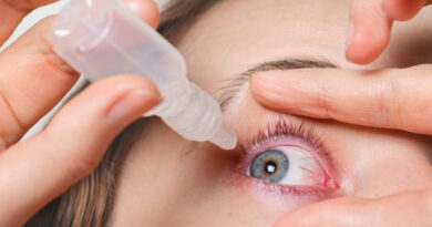 Conjunctivitis symptoms