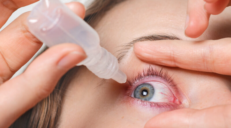 Conjunctivitis symptoms