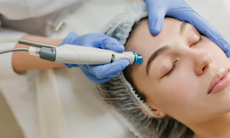 Hydrafacial Benefits